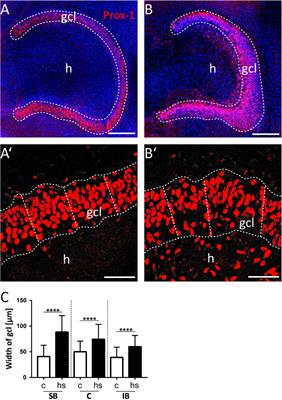 Heat-Shock Induces Granule Cell Dispersion and Microgliosis in Hippocampal Slice Cultures